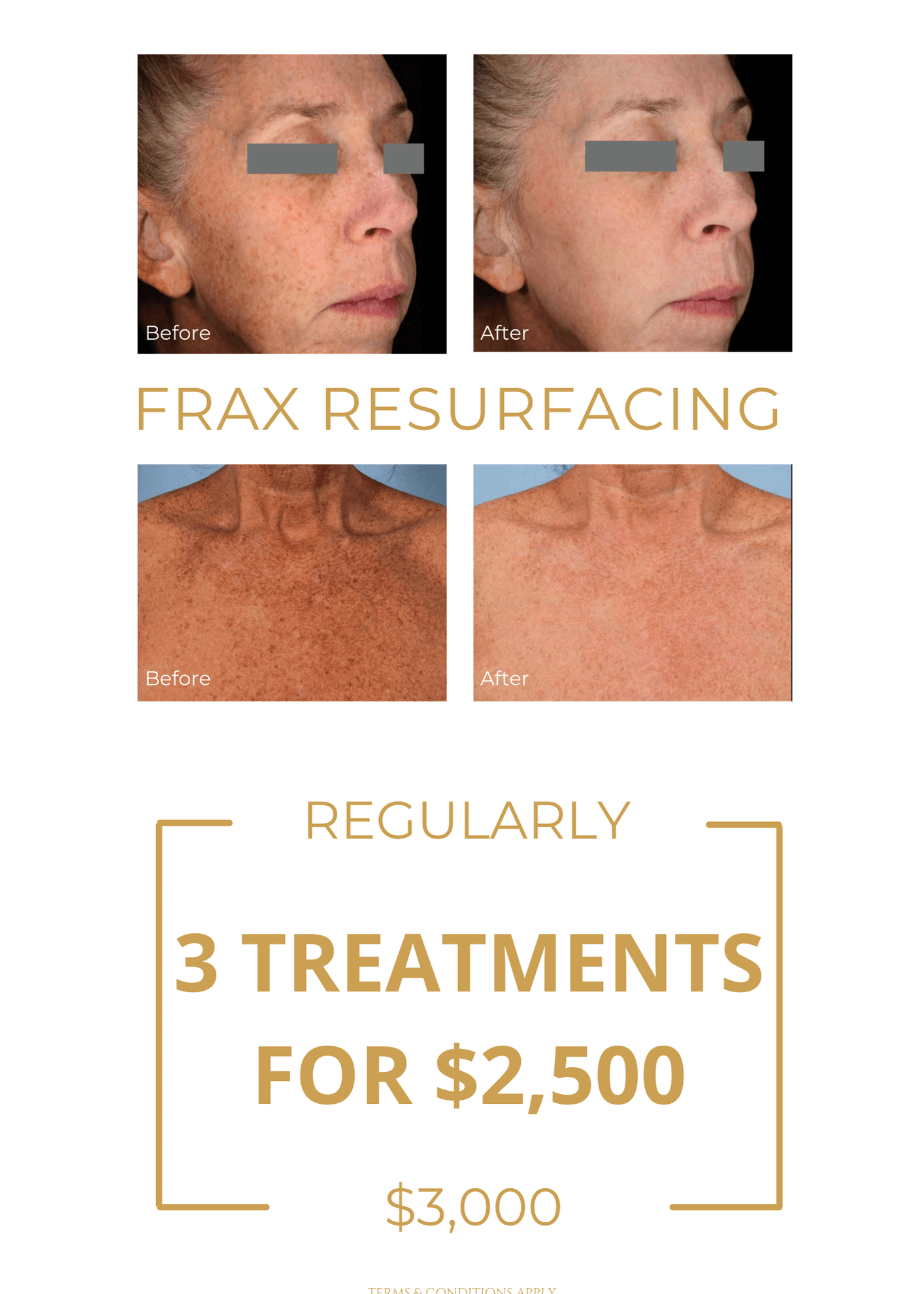 Frax Promo